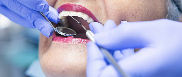 Best Dental Abscess Treatment in Hampden Sydney, VA